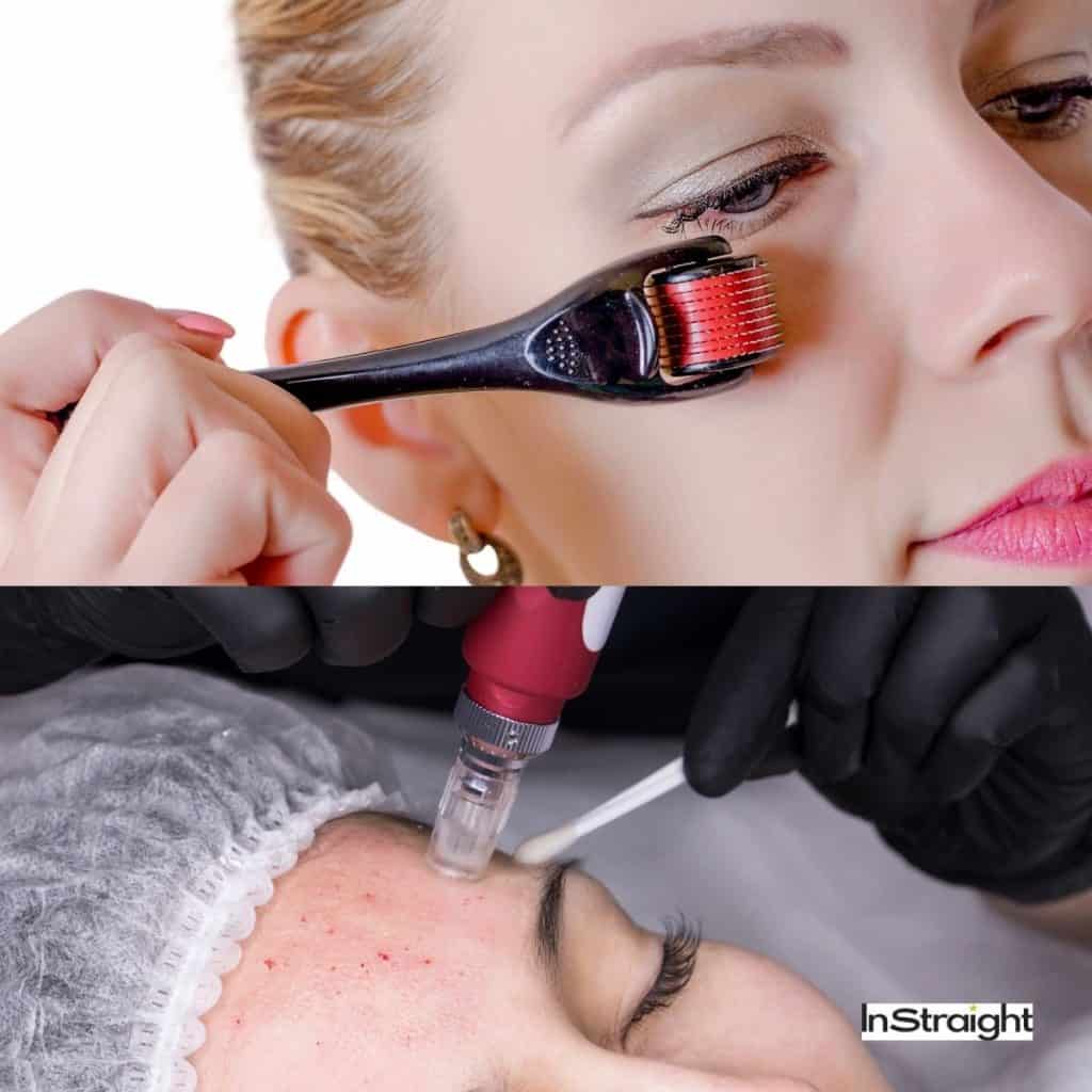 Derma roller vs microneedle procedure photos